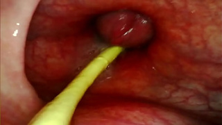 EXTREME ANAL SELF PERSPECTIVE. ONLINE CAM INSIDE HER ASS-HOLE AS I POUND HER WITH MY ENORMOUS ROD AND SPUNK DEEP INSIDE
