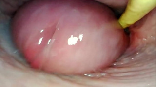 AMAZING INTERNAL POINT OF VIEW. WEBCAM INSIDE HER TWAT WHILE I FILL HER WITH JIZZ