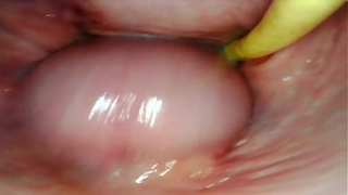 AMAZING INTERNAL SELF PERSPECTIVE. ONLINE CAMERA INSIDE HER SNATCH WHILE I FILL HER WITH SPUNK