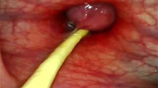 EXTREME ANAL POINT OF VIEW. ONLINE CAM INSIDE HER BUTT-HOLE AS I POUND HER WITH MY MONSTROUS MEAT AND SPERM DEEP INSIDE