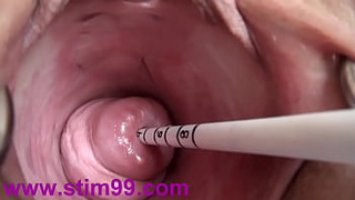 Extreme Real Cervix Fucking Insertion Asian Sounds and Objects in Uterus
